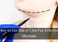 how to get rid of chin fat