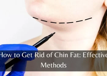 how to get rid of chin fat